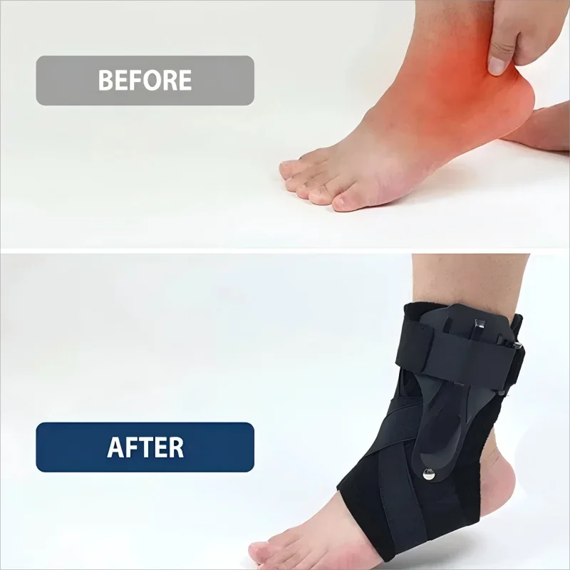 1/2PCS Ankle Brace for Sprained Ankle Support with Side Stabilizers for Men Women Ankle Splint Stabilizer Recovery Tendonitis